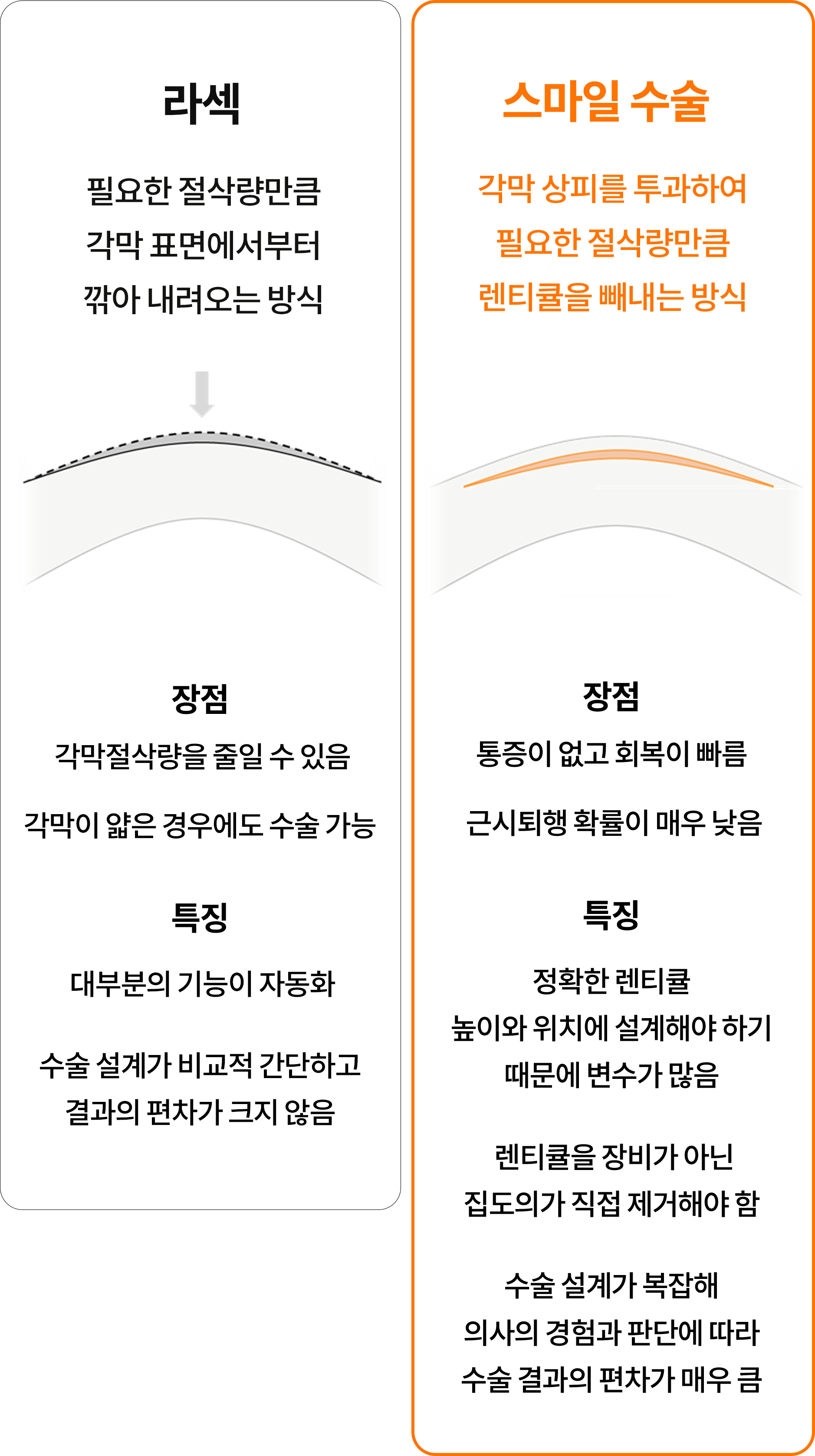 라섹 스마일 수술 비교 스마일 수술의 장점 특징 설명