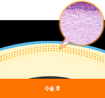 라식이미지