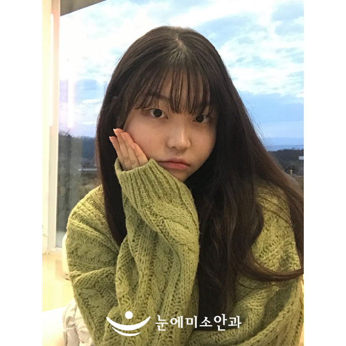 피곤하거나 두통이 있을 때 렌즈 때문에 정도가 더 심했었는데 라식 후 눈 피로도가 줄었습니다. 화장할 때, 화장 지울 때 렌즈 단계를 생략해서 일상이 간편해졌습니다.