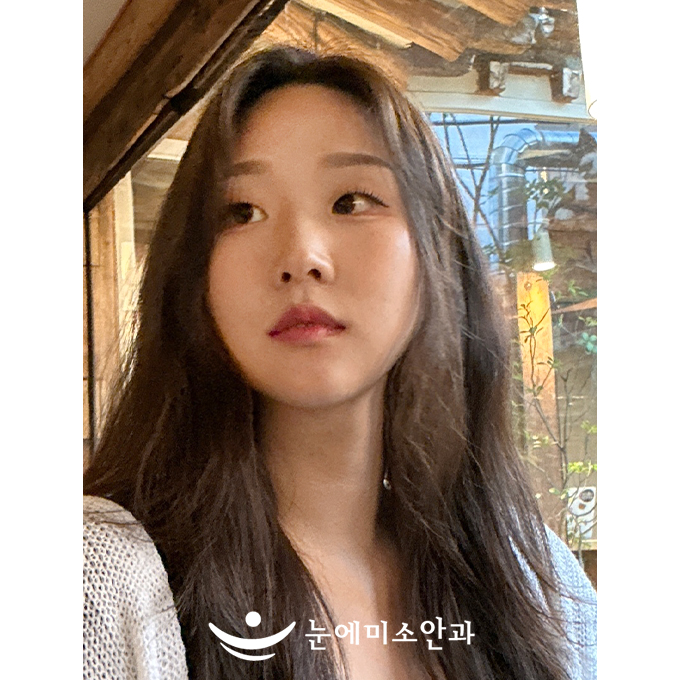 렌즈 착용 했을 때 세균성 결막염에 걸려 힘들었던 적이 있는데 이제는 안심해도 되니 좋습니다. 안보일 때 찡그리는 습관이 사라져서 매우 만족합니다.